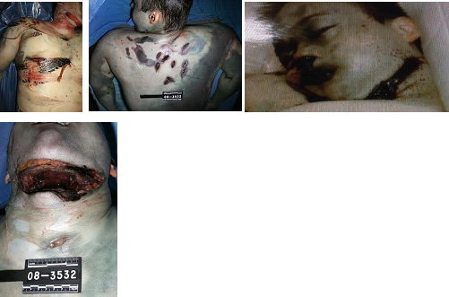 Alexander death photos